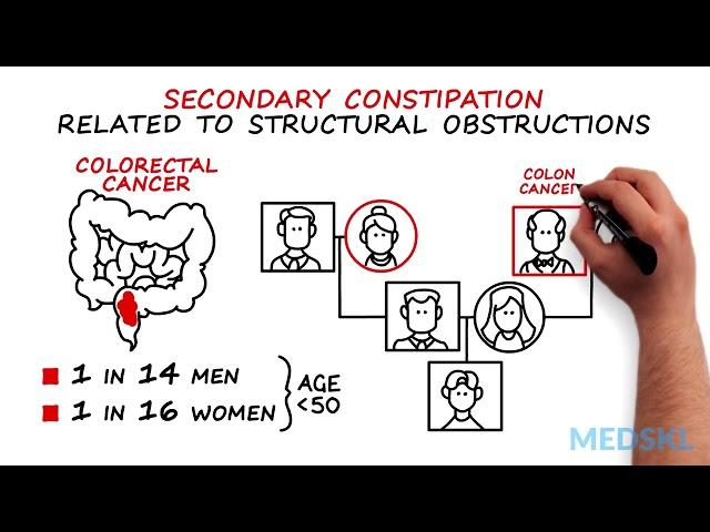 Gastroenterology - Adult Constipation - Whiteboard - Edwin Cheng - MEDSKL