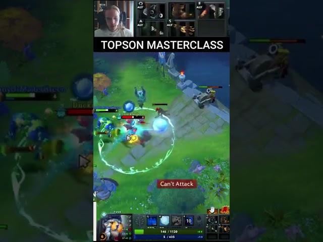 Topson micro skills sadge !!!