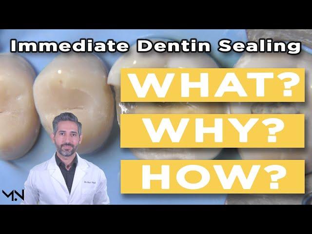 Immediate Dentin Sealing | Biomimetic Dentistry | What, Why, and How to Perform