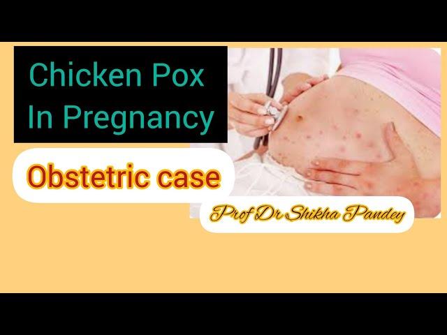 Infections in Pregnancy, Obstetrics, Varicella Zoster @saisamarthgyneclasses