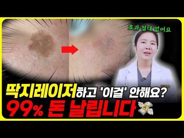 잡티, 흑자, 검버섯 떼고 주의사항? 색소치료 받고 이 영상 안 보면 후회해요!! ㅣ루비레이저,리팟레이저, 엑셀브이, 아꼴레이드 레이저 받고 절대 하면 안되는 주의사항 5가지