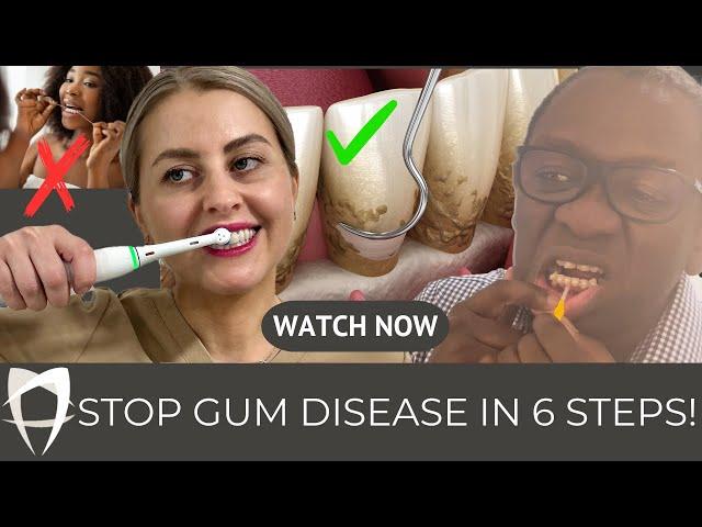 Gum Disease Treatment (2024) | Periodontist's Comprehensive Guide Including Causes and Treatment