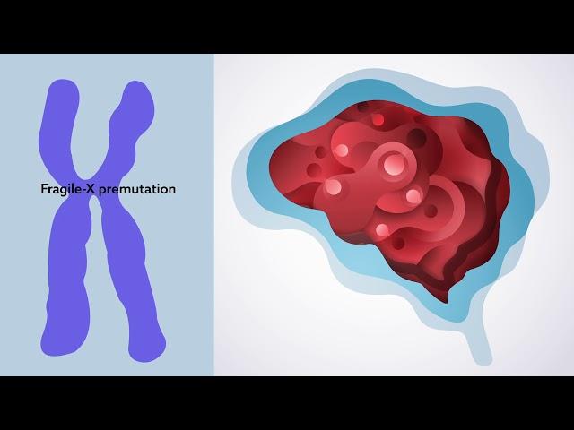 Understanding neurodevelopmental disorders and the people they affect