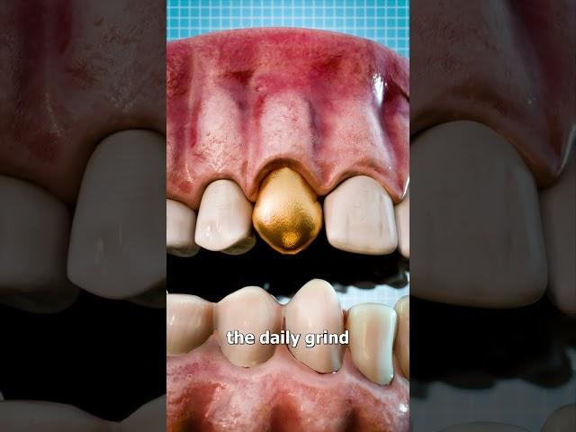 Why Dentists Still Use Gold Teeth 