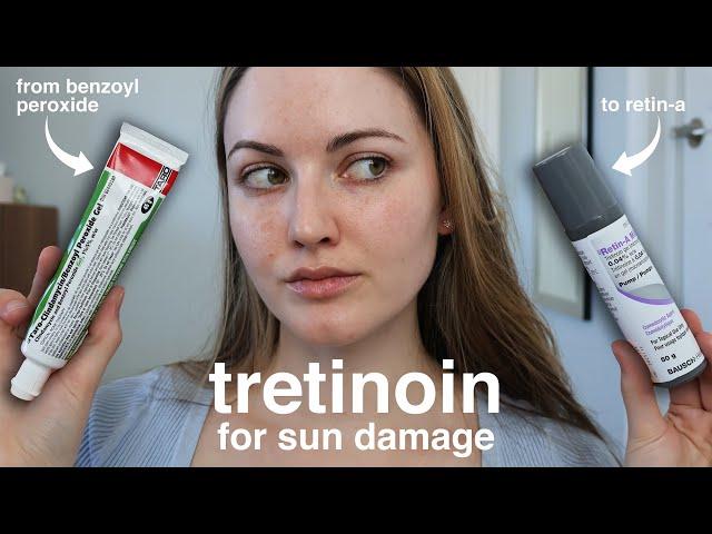 Does Tretinoin (Retin-A) Help With Sun Spots, Damage & Melasma? My 4-Month Results