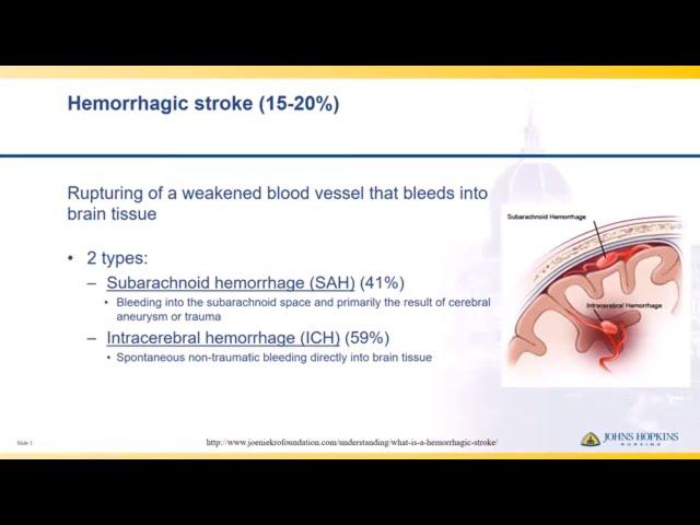 Hemorrhagic Stroke | Lisa Klein