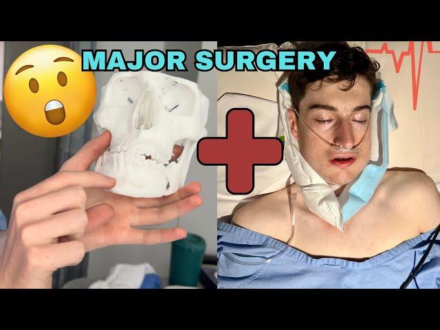 JOSH HAS MAJOR SURGERY