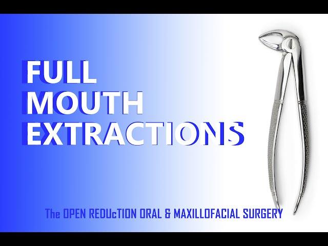 REMOVAL of ALL TEETH; the COMPLETE SURGERY! FULL MOUTH EXTRACTION CASE