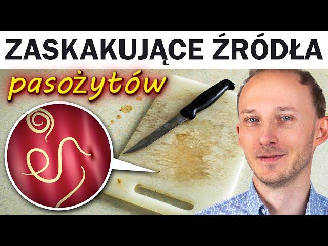 Tak ludzie łapią PASOŻYTY. Objawy i jak je zwalczyć