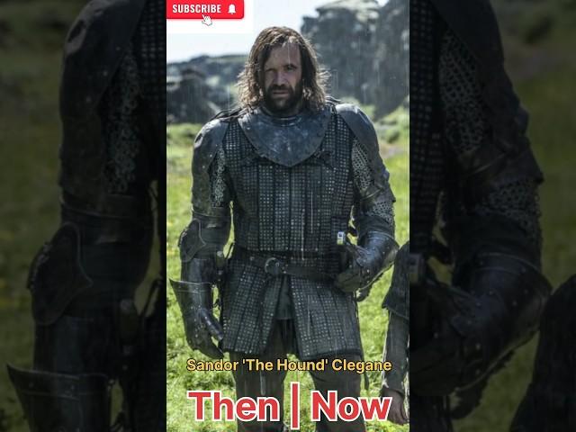 Game of trons THEN AND NOW  Rory McCann/Sandor 'The Hound' Clegane THEN AND NOW 