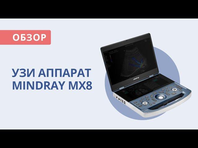 Mindray MX8 Аппарат УЗИ | Обзор от Медэк Старз