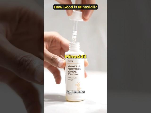 Is Minoxidil safe? #shorts