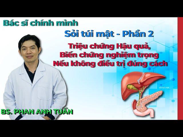 Sỏi Túi Mật Phần 2 - Những hậu quả, biến chứng nghiêm trọng nếu không điều trị đúng cách