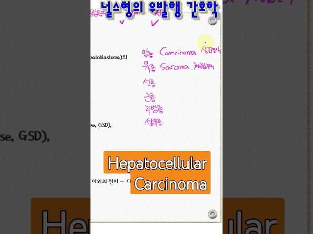 널스형의 우발행 간호학. hepatoma - hepatocellular carcinoma. 널스형의 간호병리학-간세포암