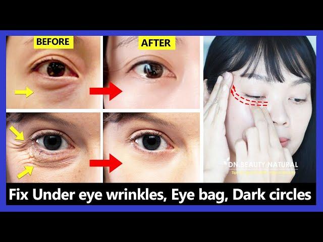 Only 6 mins!! Eye rejuvenation. Get rid of under eye wrinkles, dark circles, eye bags, Crow's feet