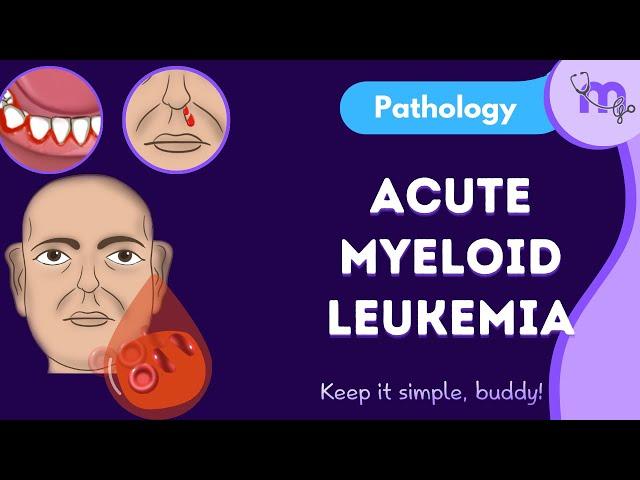 Acute Myeloid leukemia |General pathology| Examination| Diagnosis| Classification | Treatment