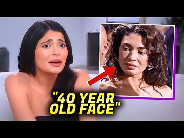 Kylie Jenner BREAKSDOWN After Her Botched Frozen Face Surgery