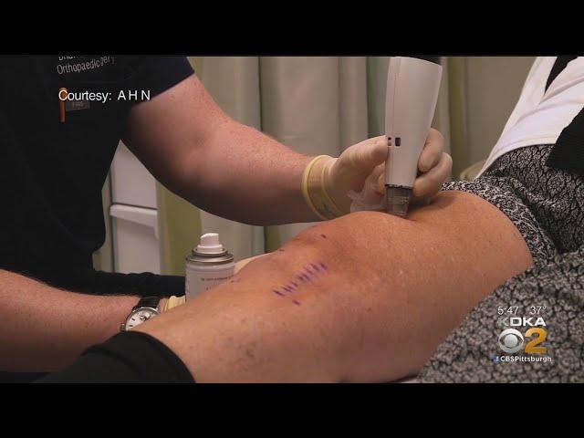 New Procedure Takes Pain Out Of Knee Replacement Surgery