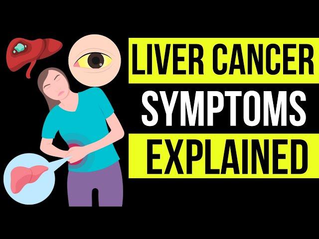 Doctor explains potential SIGNS AND SYMPTOMS of LIVER CANCER | plus causes, prevention & treatment