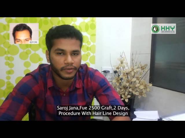 Mumbai Hair Transplant - Saroj Jana