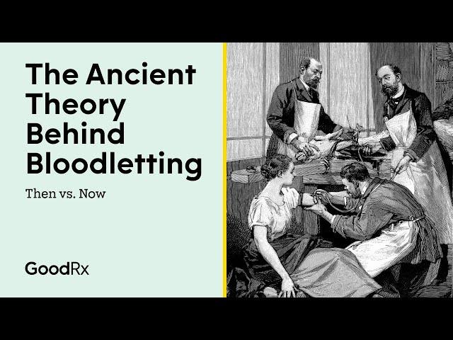 Bloodletting (Phlebotomy) Through the Ages | Then vs. Now | GoodRx