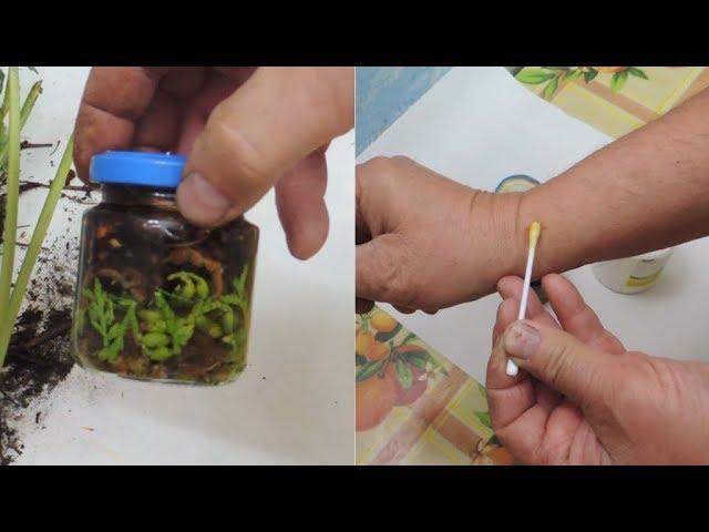 Warts, papillomas  and fungus. Triple strength composition  to remove them.
