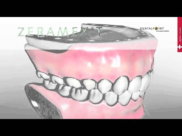 Zirconium implants Zeramex-T, Swiss made