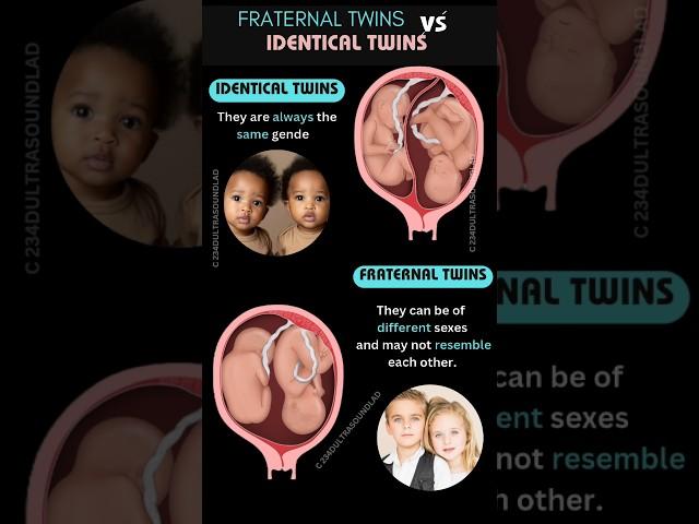 Fraternal vs Identical  Twins,A Look Inside the Womb | development stages #shortsfeed #shorts #baby