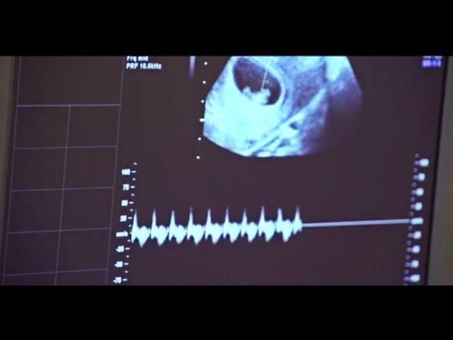 Early Pregnancy Viability Scan (7 Weeks - 11 Weeks)