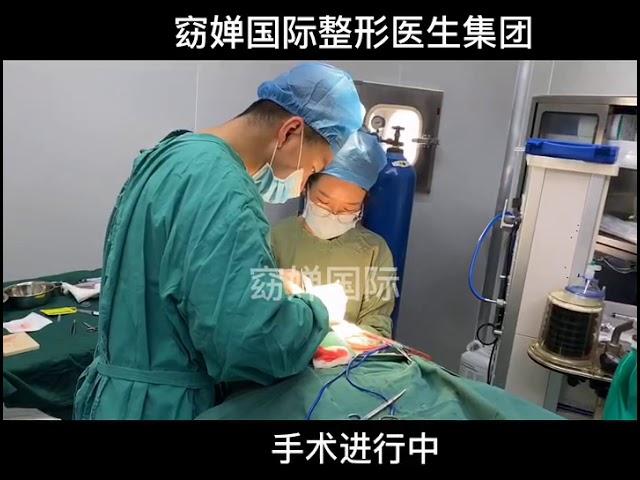 自然鼻打造完成，在手术室内的手机原相机拍摄～无可挑剔，精品美鼻