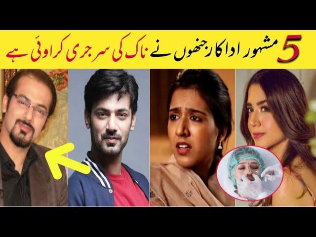 Top 5 Pakistani Celebrities Who Got Their Nose Surgery Done For Beauty  || Celeb Lights ||