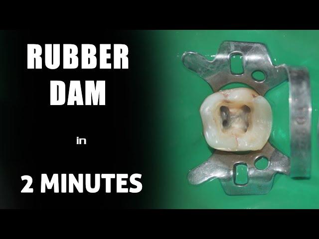 Rubber dam