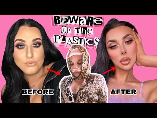 PLASTIC SURGERY BEFORE & AFTER | FACIAL FEMINISATION SURGERY RESULTS