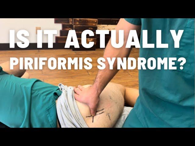 Is it actually piriformis syndrome? Here’s how an adhesion release methods specialist can tell