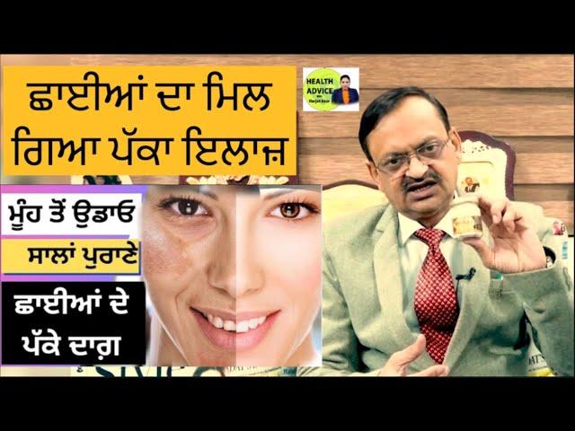 ਛਾਈਆਂ ਦਾ ਮਿਲ ਗਿਆ ਪੱਕਾ ਇਲਾਜ਼ | Face Blemishes Home Remedy | Health Advice With Harjot Kaur