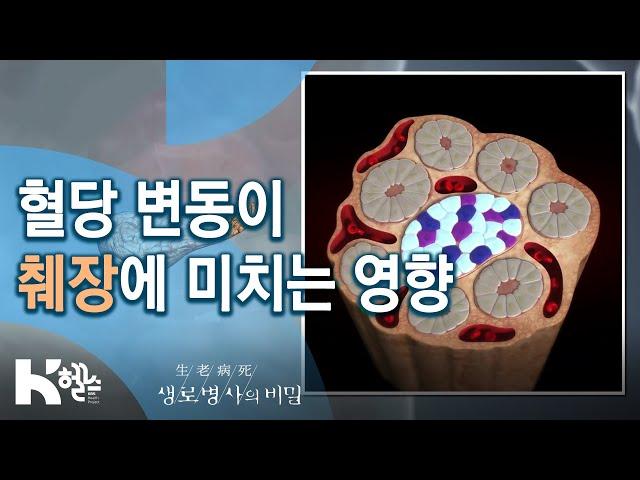 혈당 변동이 췌장에 미치는 영향 - 725회(20.02.05) 만성질환의 지름길 혈당 스파이크