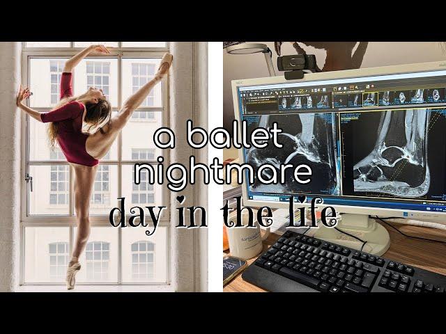 a ballet nightmare - why i need surgery