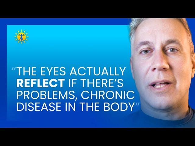 4 Natural Ways To Stop Eye Disease & Improve Vision | Dr. Sam Berne