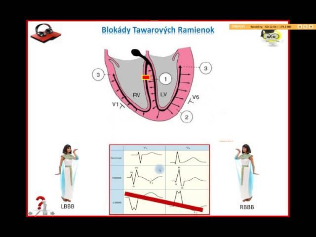 Ekg Podcast 20 of 59. Bloky Tawarových Ramienok. Part 2