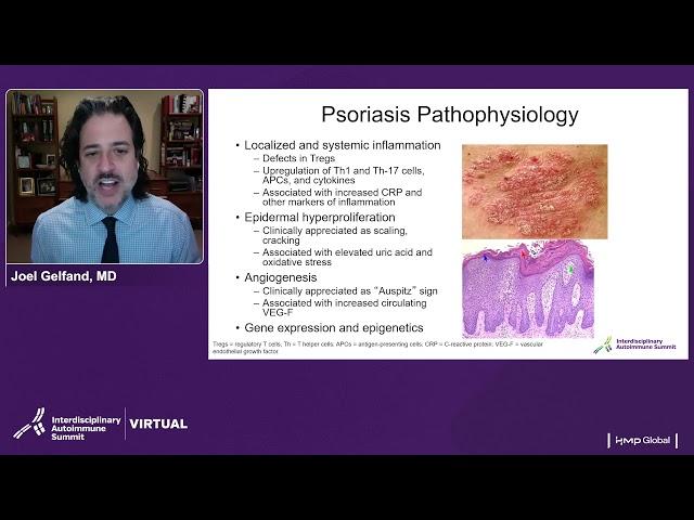 Psoriasis Treatment Update: A Focus on Targeted Therapies