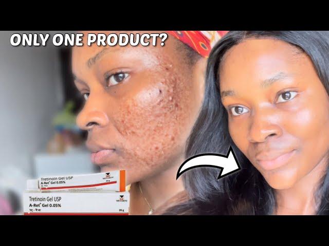 HOW TO ACHIEVE YOUR DREAM SKIN WITH TRETINOIN | How to use Tretinoin for beginners #tretinoin