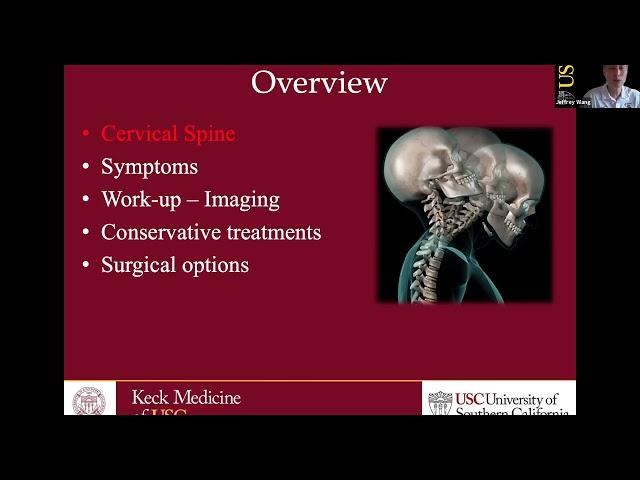 Cervical Disc Disorders with Radiculopathy and Surgical Options | Traumatic Spinal Cord Injury