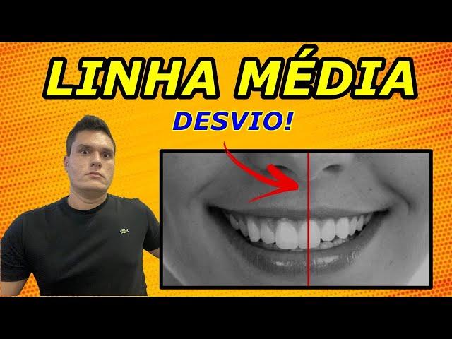 DESVIO DE LINHA MÉDIA DENTÁRIA | COMO O DENTISTA CORRIGE COM APARELHO ORTODÔNTICO?