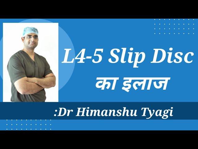 L4-5 Slip Disc का इलाज/ L4-5 Slip Disc Treatment