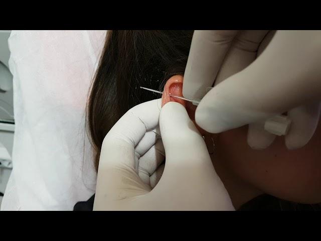 Kıkırdak  ( Helix ) Piercing Delimi