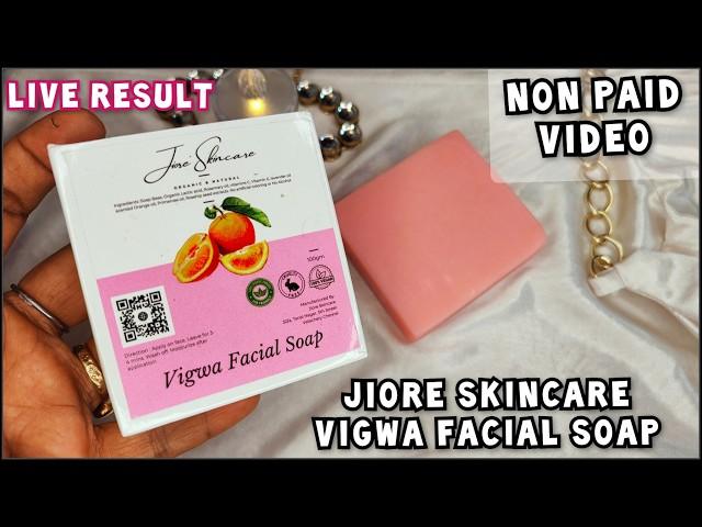 Jiore Sinche Soap Review | Jiore Sinche Facial Soap |Best skin whitening soap review | #suntan #sale