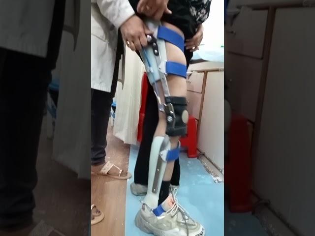 Knee Ankle Foot Orthosis/ Polio Caliper.