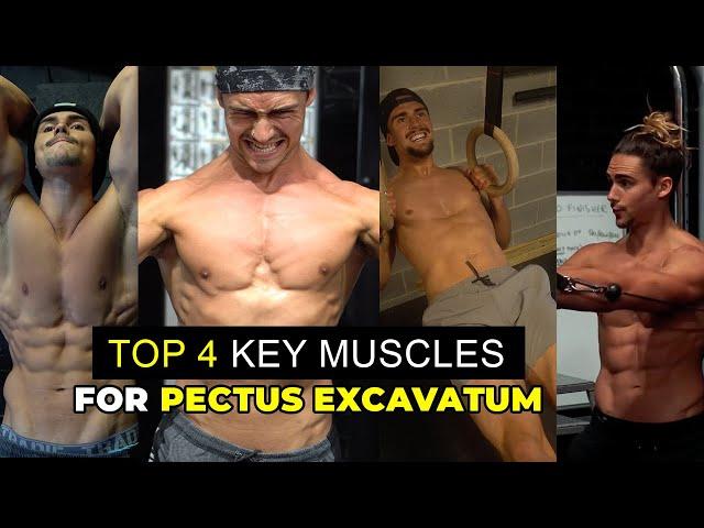 TOP 4 MUSCLES TO FOCUS ON TO IMPROVE PECTUS EXCAVATUM WITH EXERCISE