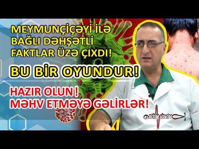 Həkim meymunçiçəyi ilə bağlı elə şeylərin üstünü açdı ki.. - MƏQSƏDLƏRİ HAMINI MƏHV ETMƏKDİR! #viral