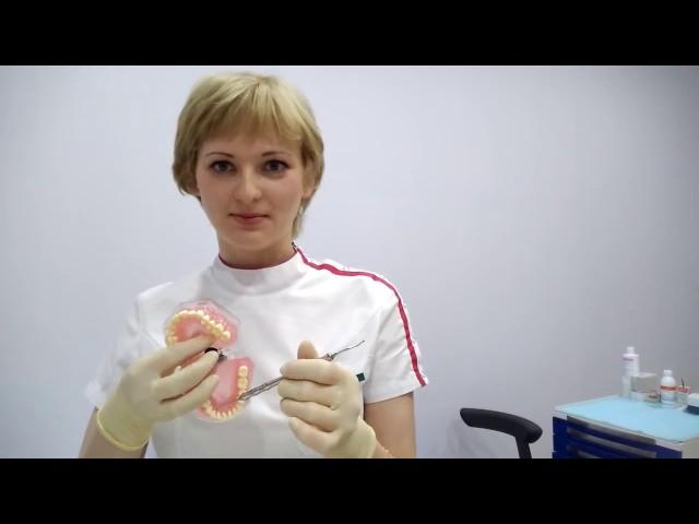 Залежи зубного камня